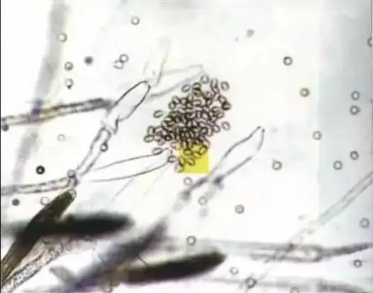 Aquaculturists need to watch out for these diseases in December!