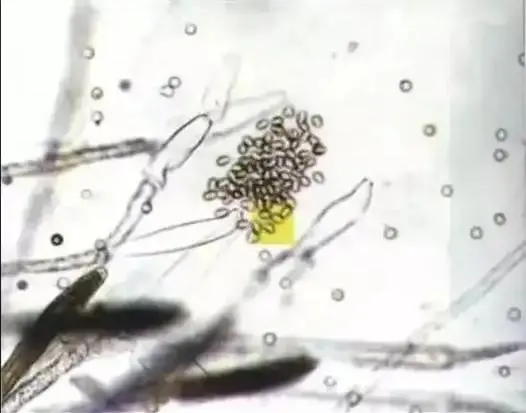 With the arrival of low temperatures, will fish grow hair? Please save this guide for the prevention and control of water mold disease!